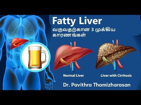 Fatty Liver வருவதற்கான 3 முக்கிய காரணங்கள் | Dr. Pavithra Thamizharasan